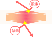 緊張性筋痛